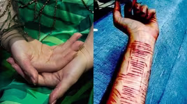 Ngoài tự bóc da tay, giới trẻ còn có nhiều cách tự ngược đãi bản thân kinh khủng hơn