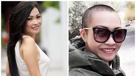 [ẢNH] Dàn mỹ nhân gây sốc khi cạo trọc đầu vẫn đẹp xuất sắc