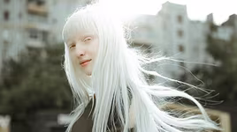 [ẢNH] Ngỡ ngàng trước vẻ đẹp khác biệt của những người mẫu bạch tạng nổi tiếng thế giới