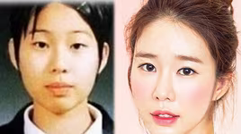 [ẢNH] Bất ngờ trước hành trình "dao kéo" của 4 mỹ nhân xứ Hàn