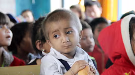 Cậu bé tí hon, 9 tuổi cao 56cm, nặng 4kg