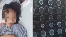 Vụ nữ sinh Quảng Ninh bị đánh nhập viện: Chờ cơ quan Công an xử lý theo quy định pháp luật