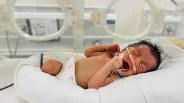 Bé sinh non bị bỏ rơi bên đường, tính mạng nguy kịch được bác sĩ cứu sống