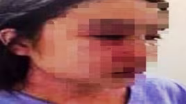 Bác sỹ nghi đánh nữ điều dưỡng ở Huế có bị xử lý hình sự?