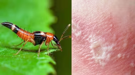 [Ảnh] Nhận diện những dấu hiệu tổn thương do kiến ba khoang và cách xử lý 