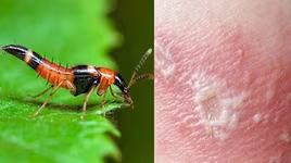 [CLIP] Những cách xử lý nhanh khi bị kiến ba khoang ‘tấn công’