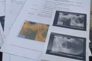 Góc khuất nghề đẻ thuê (5): Người thuê "phủi tay" vì thai nhi là con gái