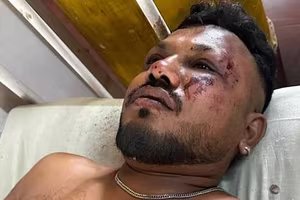 Hành khách duy nhất sống sót kể lại giây phút kinh hoàng khi máy bay gặp nạn ở Ấn Độ