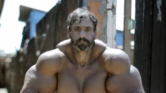 Nghiện tiêm dầu để có bắp tay khủng như người khổng lồ xanh 