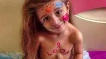 Cuộc sống đầy màu sắc của cô bé có trái tim nằm ở... bụng