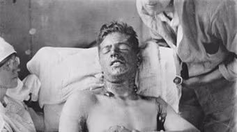 5 loại vũ khí hóa học cực độc bị cấm sử dụng trong chiến tranh 