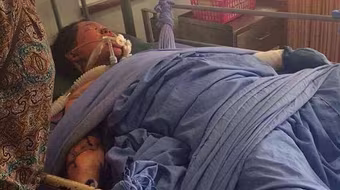 Bị chồng đổ xăng đốt vì đăng ảnh "tự sướng" trên Facebook