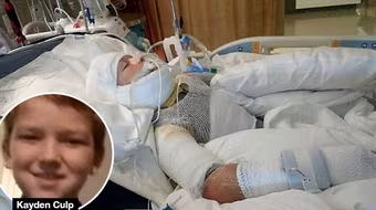 Mỹ: Bé trai 10 tuổi bị bạn tưới xăng đốt