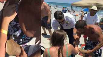 Nhập viện với cá mập dính trên tay