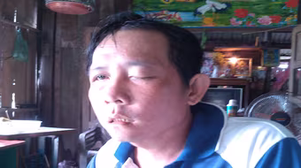 Nhổ răng làm mù mắt, người đàn ông gửi đơn "kêu cứu"