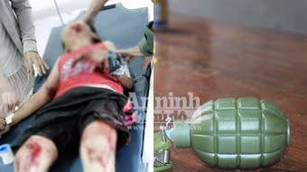 Nổ lựu đạn đồ chơi, hai cháu bé bị thương