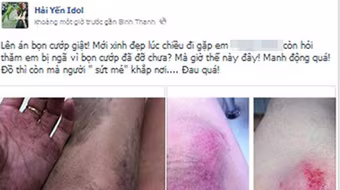 Hàng loạt sao Việt từng trầy da xước mặt vì bị cướp giật ở TP.HCM