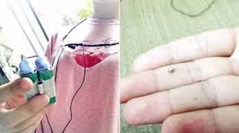 Thi THPT quốc gia: "Tuyệt chiêu" gian lận sử dụng tai nghe siêu nhỏ bằng hạt đậu