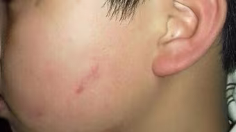 Hà Nội xử lý nghiêm cô giáo cho 43 học sinh lớp 4 tát bạn