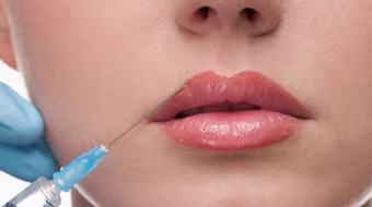 Đi thẩm mỹ tại cơ sở hành nghề "chui", thiếu nữ bị hoại tử toàn bộ môi dưới