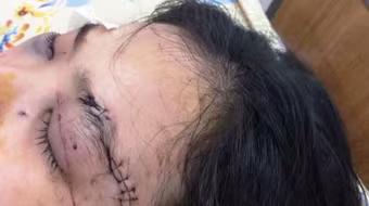 Điều tra vụ cô gái dẫn 20 giang hồ truy sát kinh hoàng 1 thiếu nữ 16 tuổi