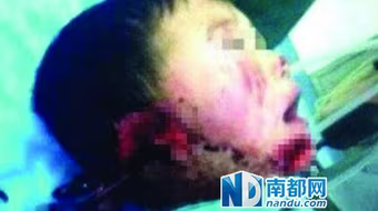 Trung Quốc: Một bé trai bị hành hung