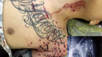 Khởi tố một bị can trong vụ nổ súng gần khu vực trạm thu phí BOT ở Thái Bình