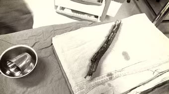 Uống rượu say đi xe máy, nam thanh niên bị cành cây đâm xuyên vùng mặt