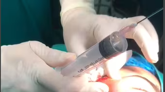 Nữ sinh 16 tuổi ở Bắc Kạn mù mắt do tiêm filler nâng mũi