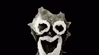 Amip ăn não - mắc bệnh là coi như... xong!