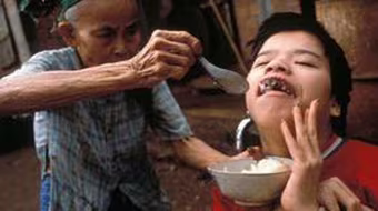 50 năm thảm họa da cam