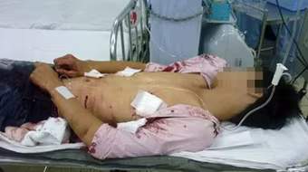 Nhát dao lấy mạng người 