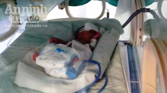 Cứu sống kỳ diệu cháu bé sinh non nặng chỉ nặng 500 gam 