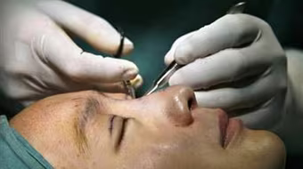 Mốt làm đẹp bằng... dao kéo