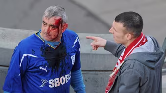 CĐV Cardiff bị đánh vỡ đầu sau CK Carling Cup