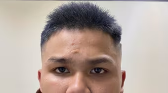 Bắt gã trai chặn đường, cướp tài sản lúc rạng sáng