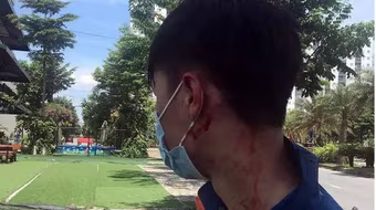 Truy bắt các đối tượng cướp điện thoại của tài xế 'xe ôm' công nghệ