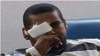 "Dê xồm" bị bắn thủng mắt khi giở trò