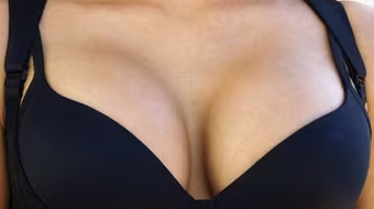 Dùng ngực đè chết bạn trai trong lúc say xỉn