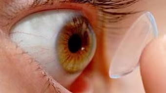 Cô gái 18 tuổi suýt bị mù mắt vì kính áp tròng