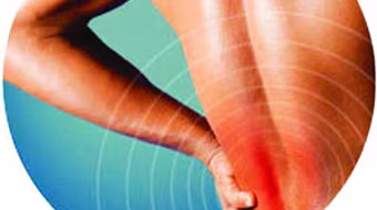 Đau thắt lưng, nguyên nhân hàng đầu gây liệt