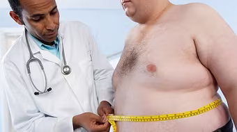 Béo phì nặng rút ngắn của bạn 14 năm tuổi thọ