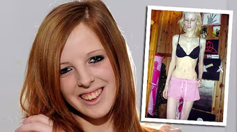 Bị chế giễu, cô gái nhịn ăn gầy như xác khô