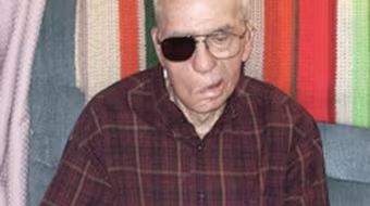 Thọ trăm tuổi với mảnh đạn "găm" trong đầu