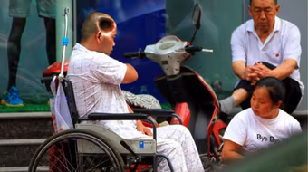 Phi thường người đàn ông sống với lỗ hổng trên đầu