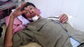 Trộm chó bị phát hiện, lao thẳng xe vào bảo vệ tổ dân phố