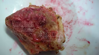 Nghệ An: Thịt lợn luộc chín bỗng xuất hiện màu đỏ thẫm