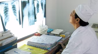 Bệnh lao ngày càng trẻ hóa