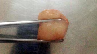 Hà Nội: Hóc vải, bé trai 6 tuổi tử vong thương tâm