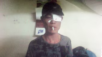 “Ăn vạ” - họa liền thân!